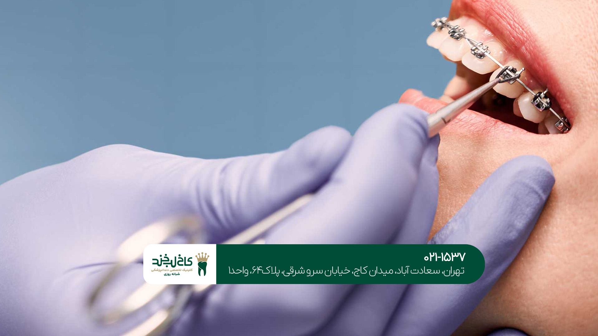 دندانپزشکی در تهران