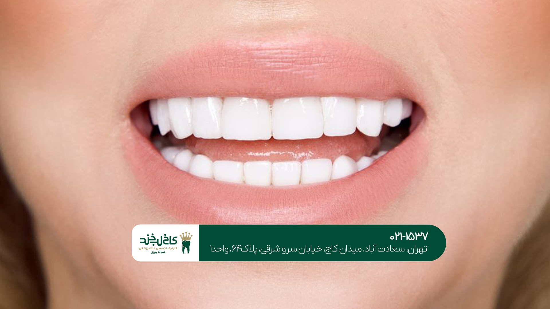 کلینیک دندانپزشکی زیبایی کلینیک دندانپزشکی زیبایی