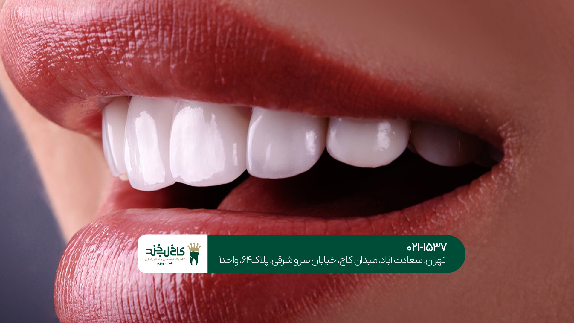 کلینیک دندانپزشکی زیبایی کلینیک دندانپزشکی زیبایی