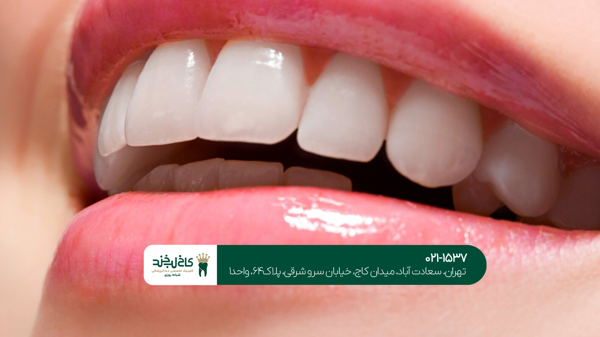 کلینیک دندانپزشکی زیبایی کلینیک دندانپزشکی زیبایی