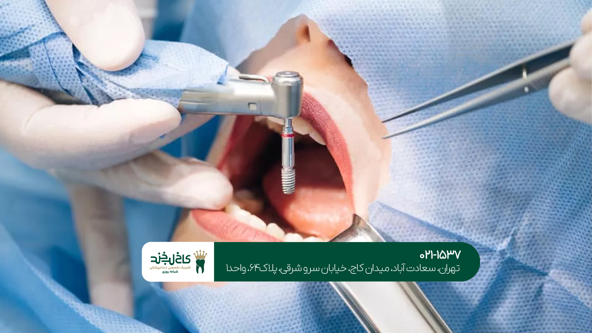کلینیک دندانپزشکی تخصصی ایمپلنت کلینیک دندانپزشکی تخصصی ایمپلنت