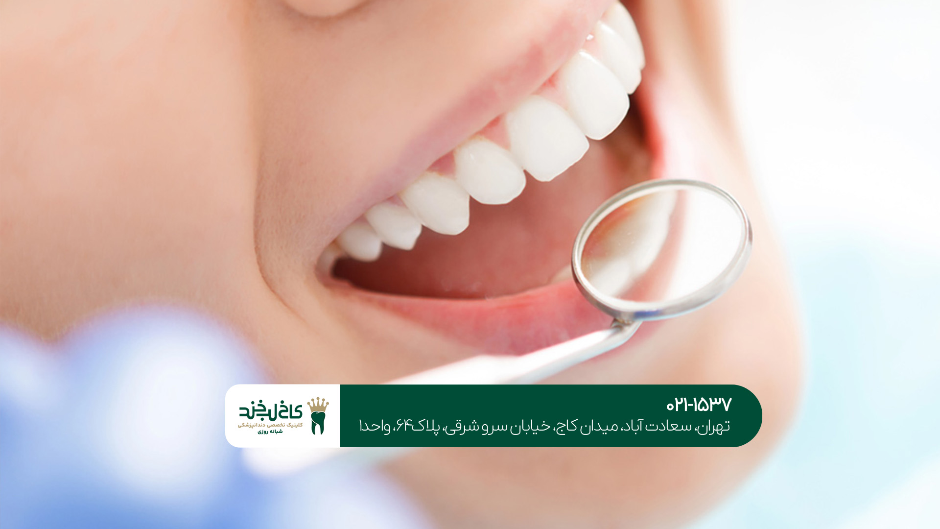 بهترین دندانپزشکی اقساطی تهران بهترین دندانپزشکی اقساطی تهران