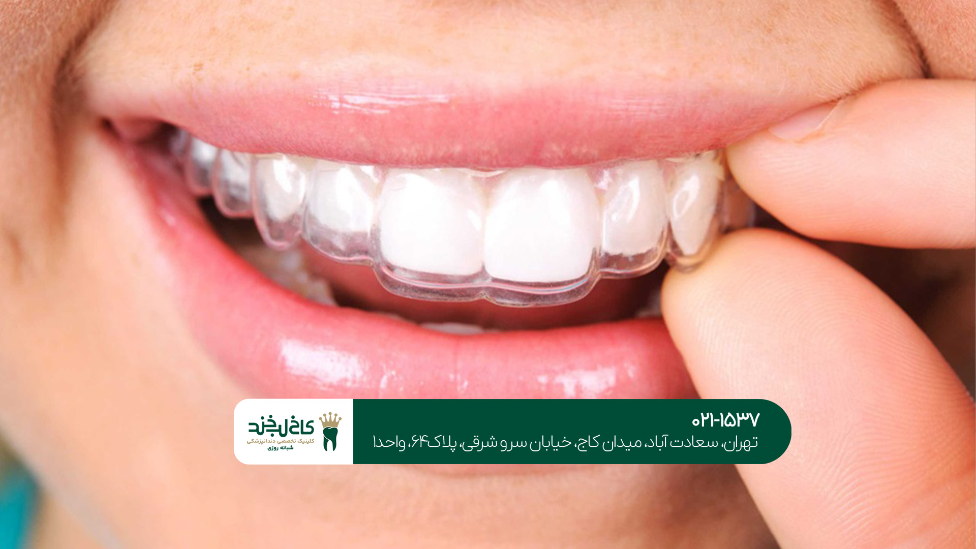 بهترین دندانپزشکی اقساطی تهران بهترین دندانپزشکی اقساطی تهران