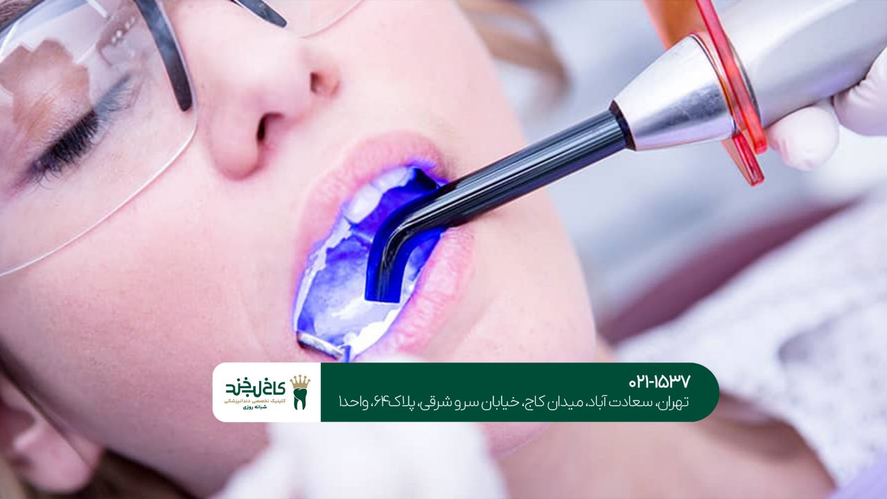  کامپوزیت دندان طبیعی و بادوام