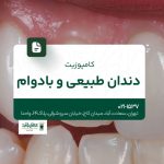 کامپوزیت دندان طبیعی و بادوام