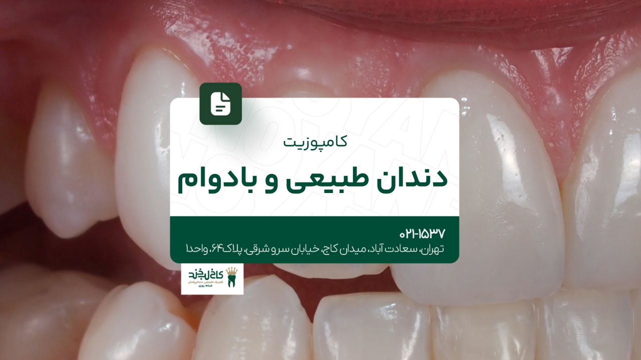  کامپوزیت دندان طبیعی و بادوام