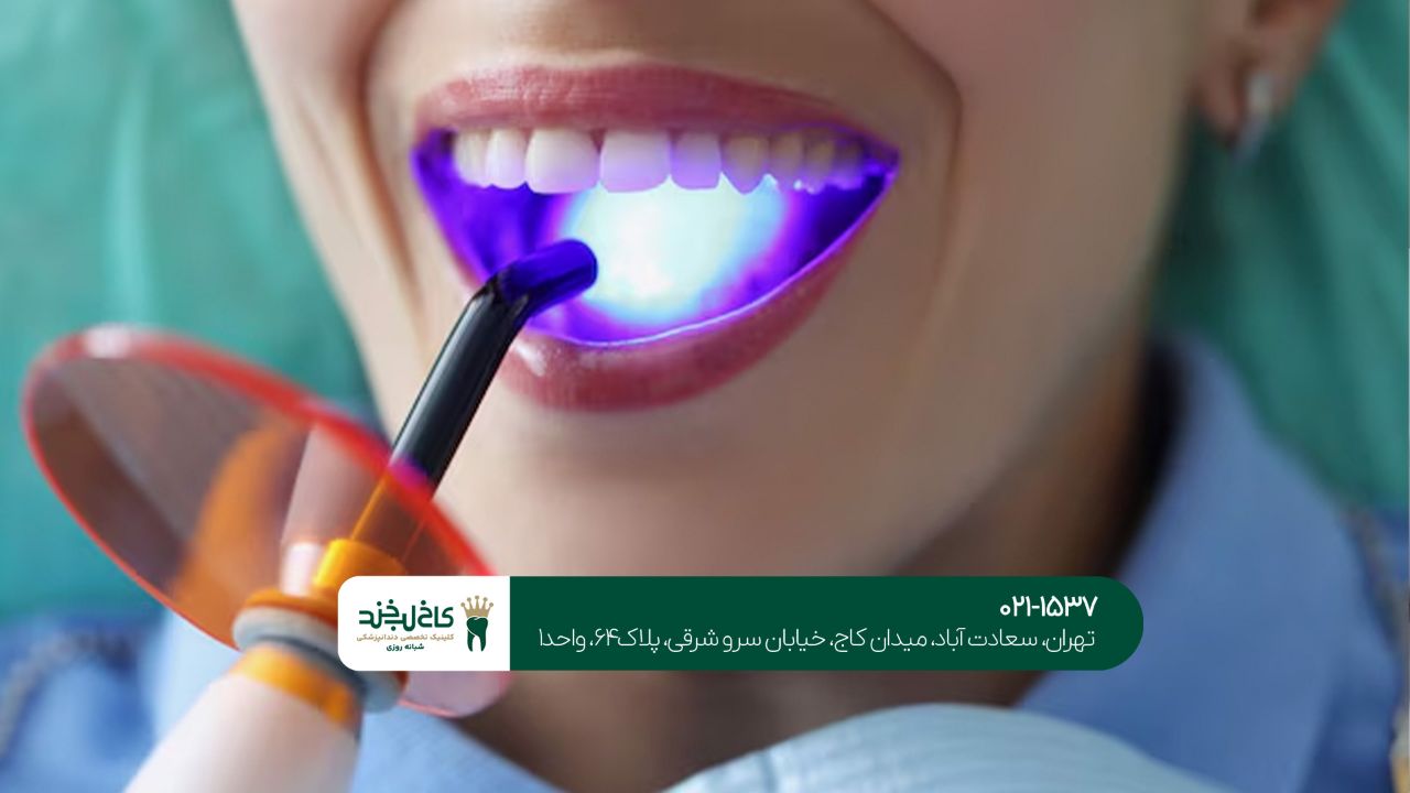  کامپوزیت دندان طبیعی و بادوام