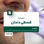لمینت قسطی دندان