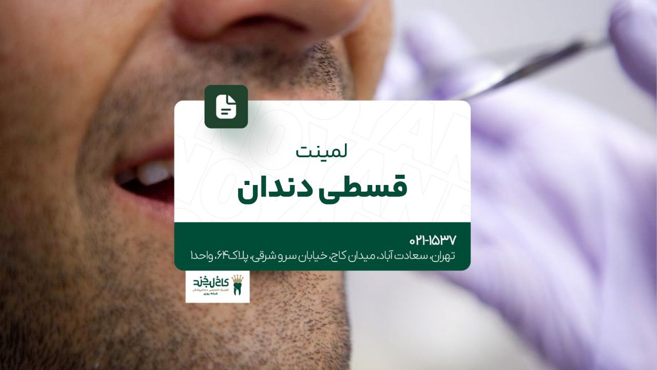لمینت قسطی دندان