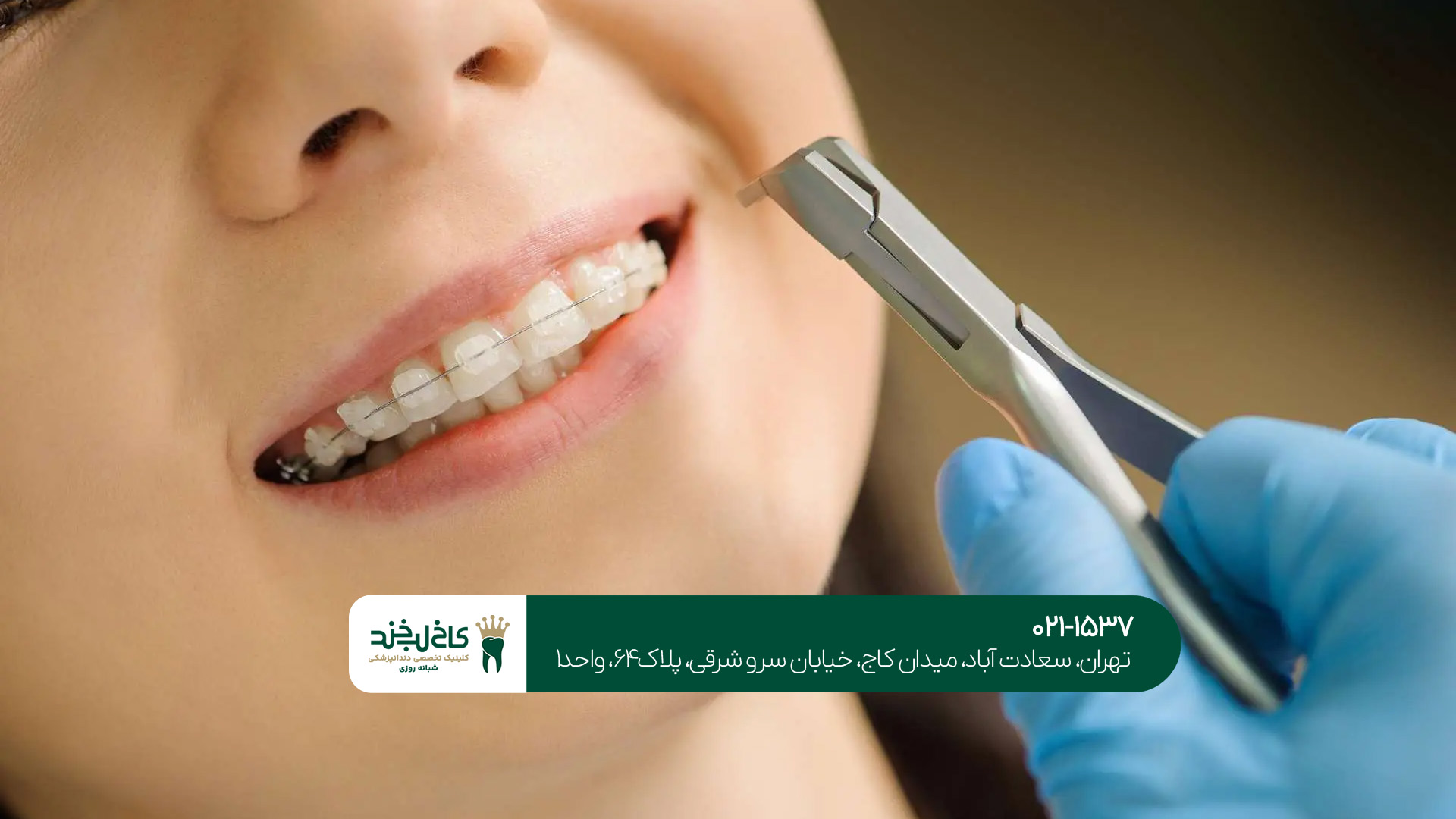 ارتودنسی دندان ارتودنسی دندان