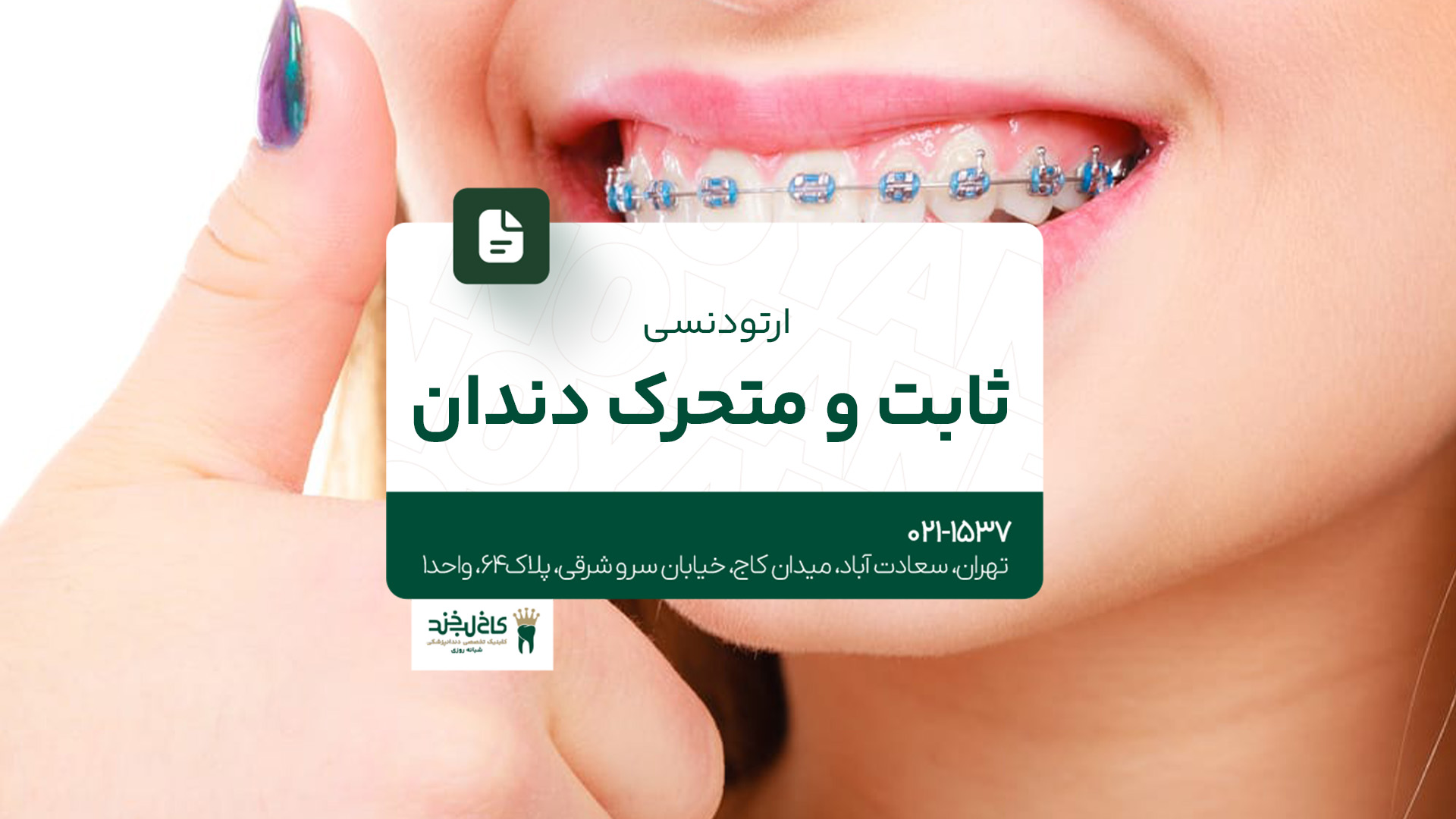 ارتودنسی دندان ثابت و متحرک ارتودنسی دندان ثابت و متحرک