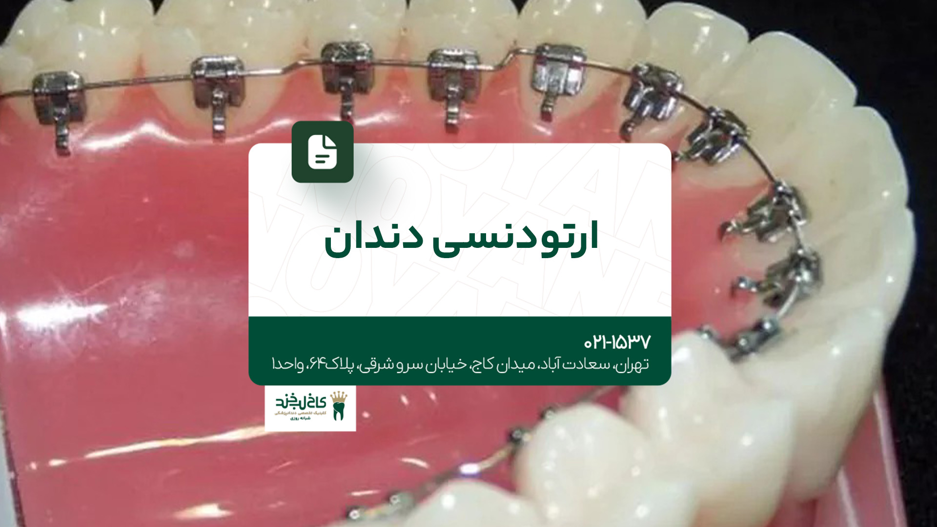 ارتودنسی دندان