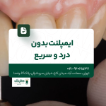 ایمپلنت بدون درد و سریع