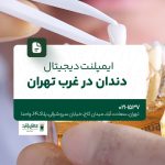 ایمپلنت دیجیتال دندان در غرب تهران