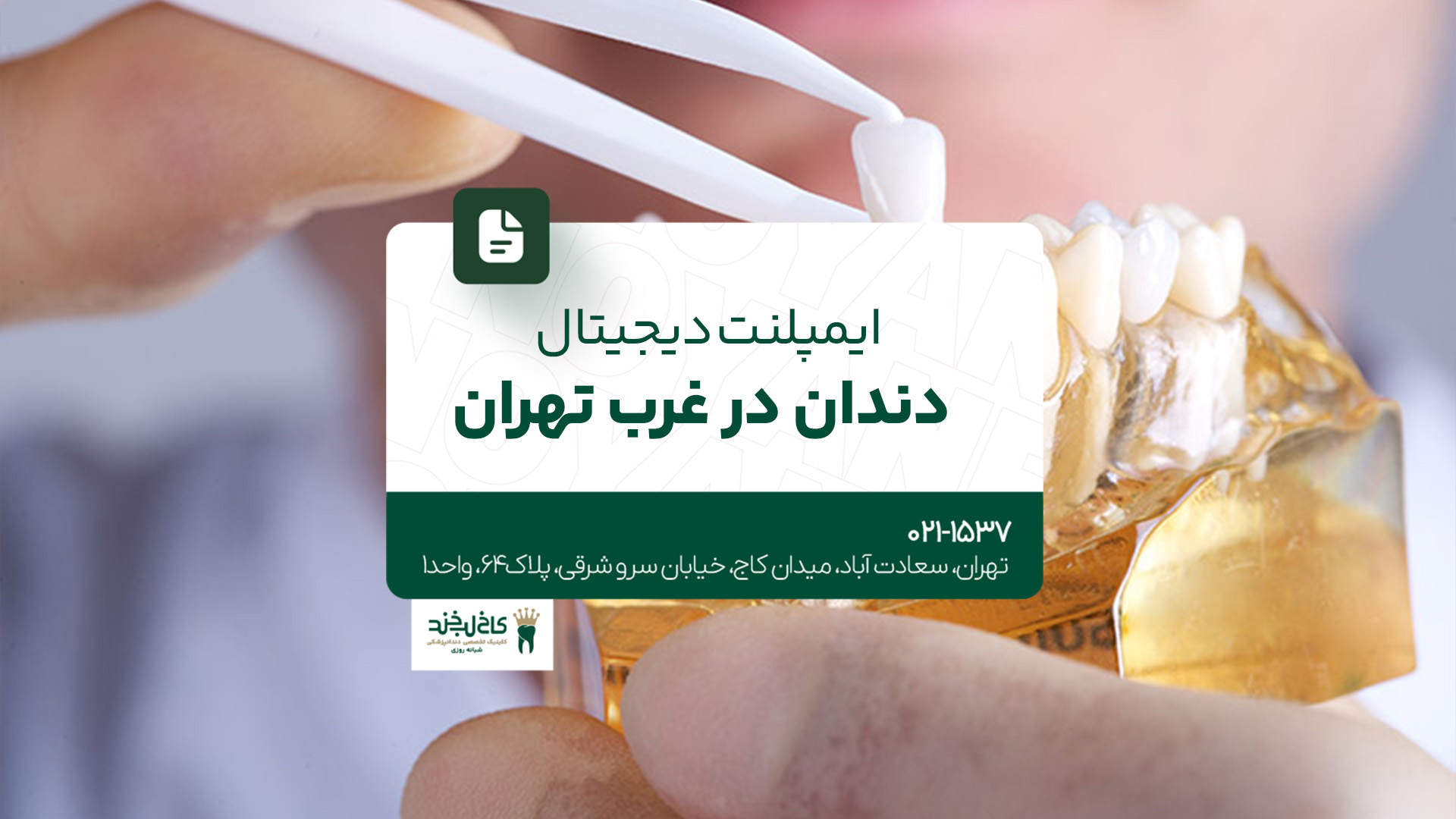ایمپلنت دیجیتال دندان در غرب تهران
