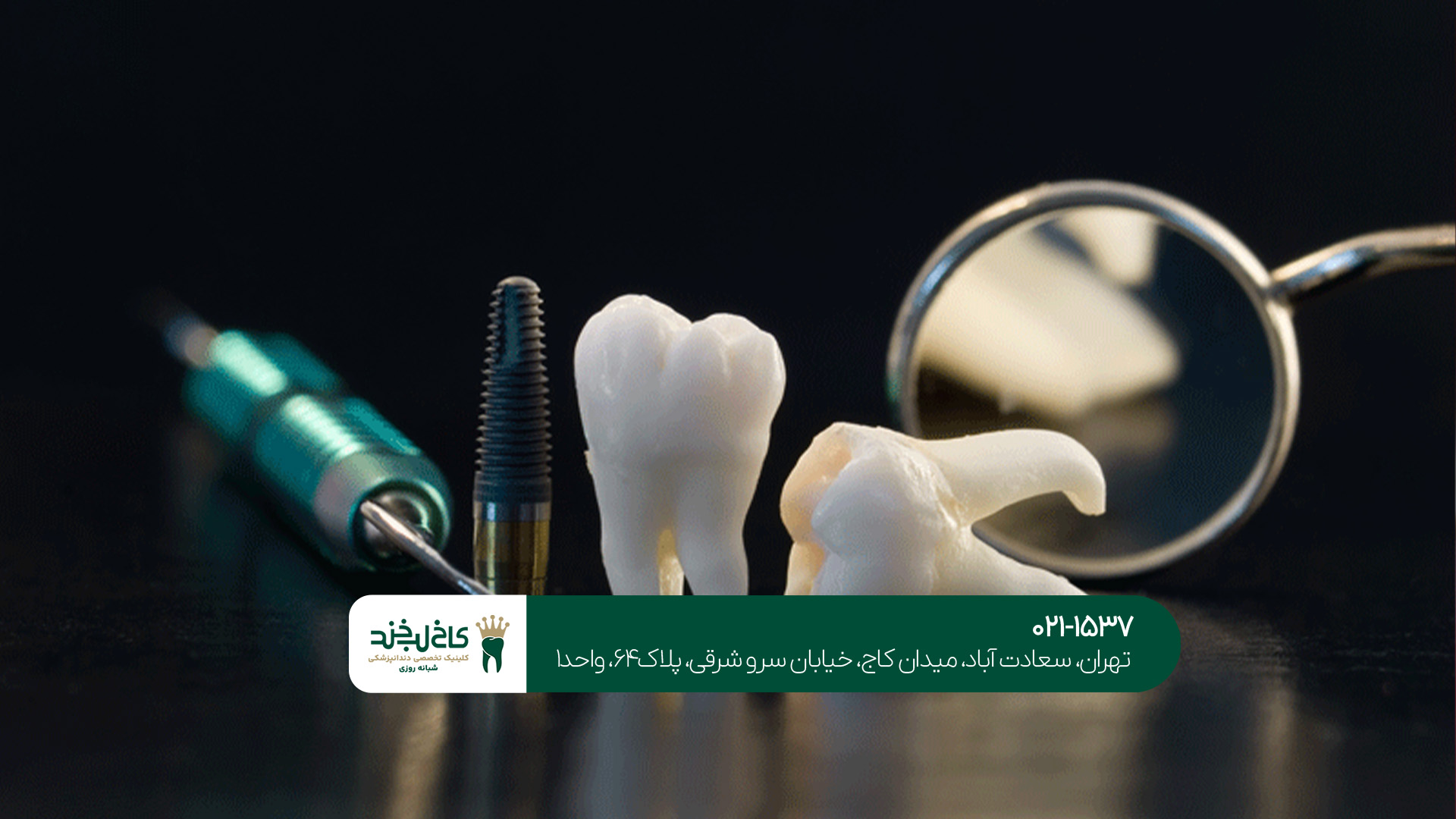 مراحل ایمپلنت دیجیتال