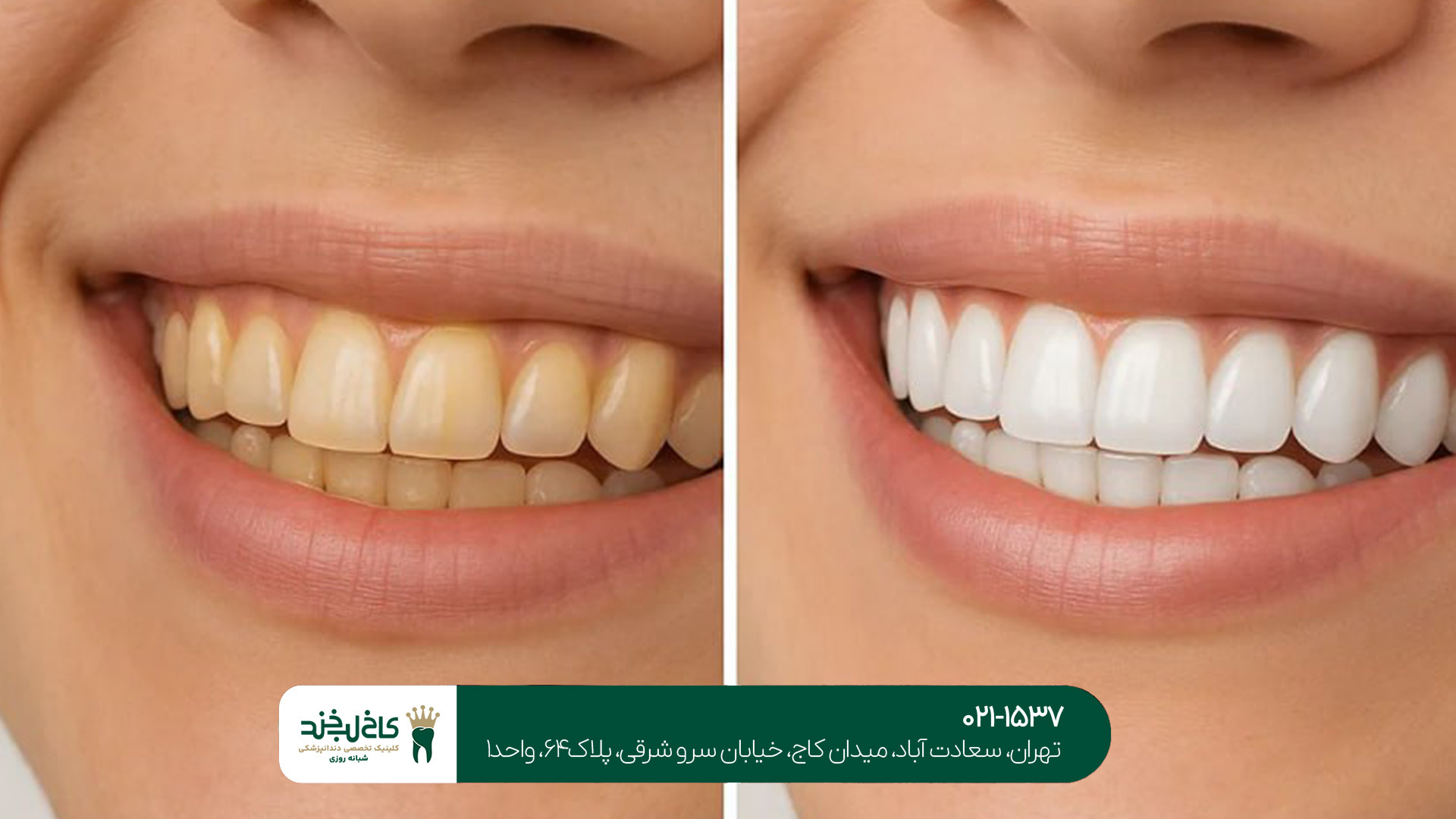 دندان پزشکی