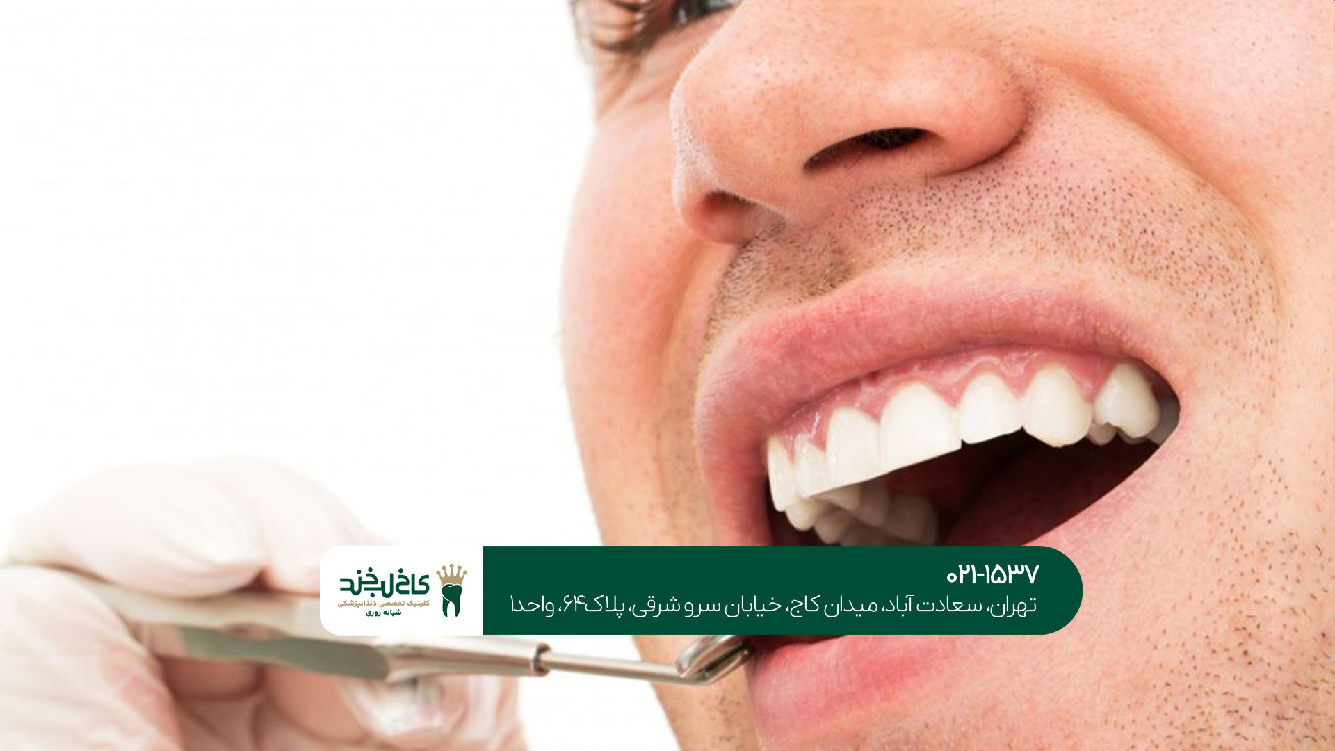 بهترین برندهای ایمپلنت دندان