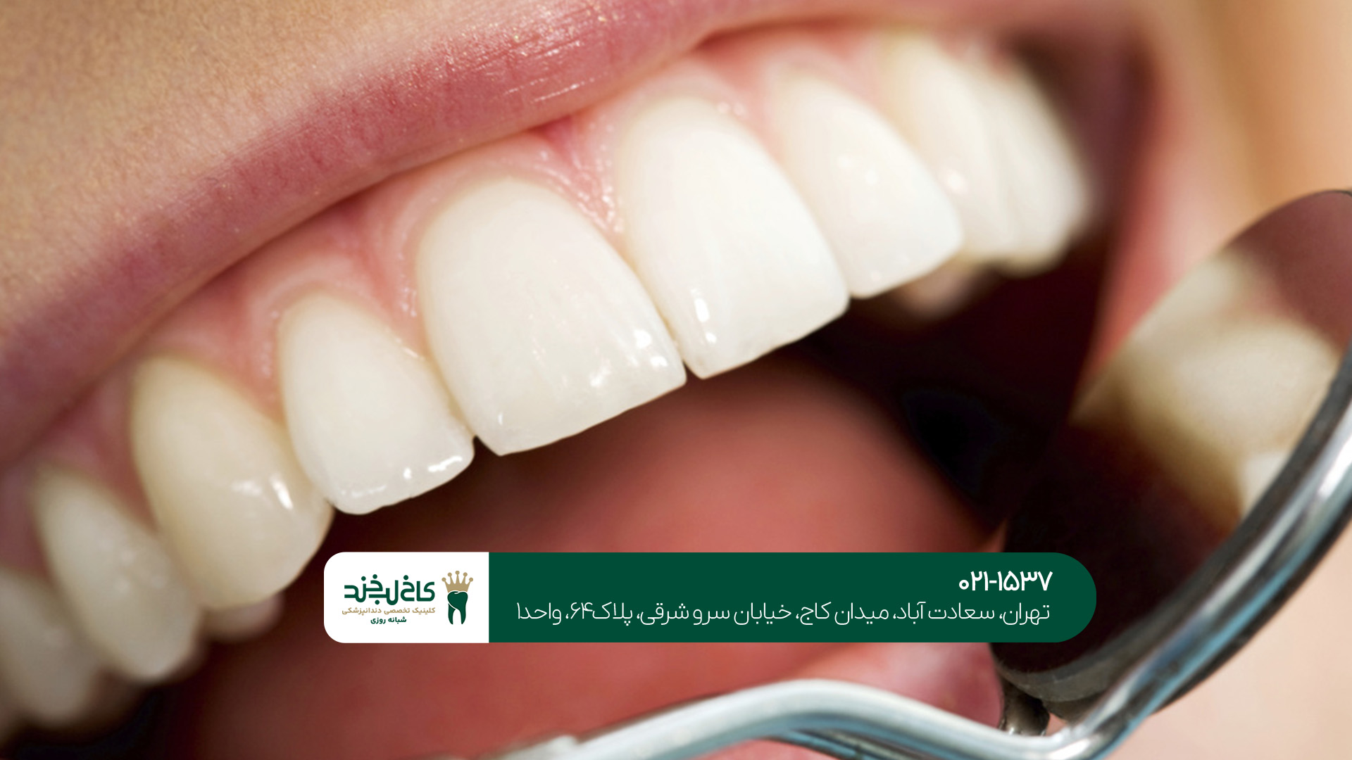 بهترین دندانپزشکی تهران بهترین دندانپزشکی تهران