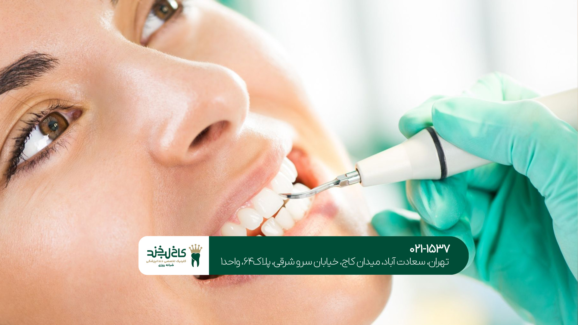 بهترین شرایط اقساطی دندان بهترین شرایط اقساطی دندان