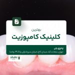 بهترین کلینیک کامپوزیت