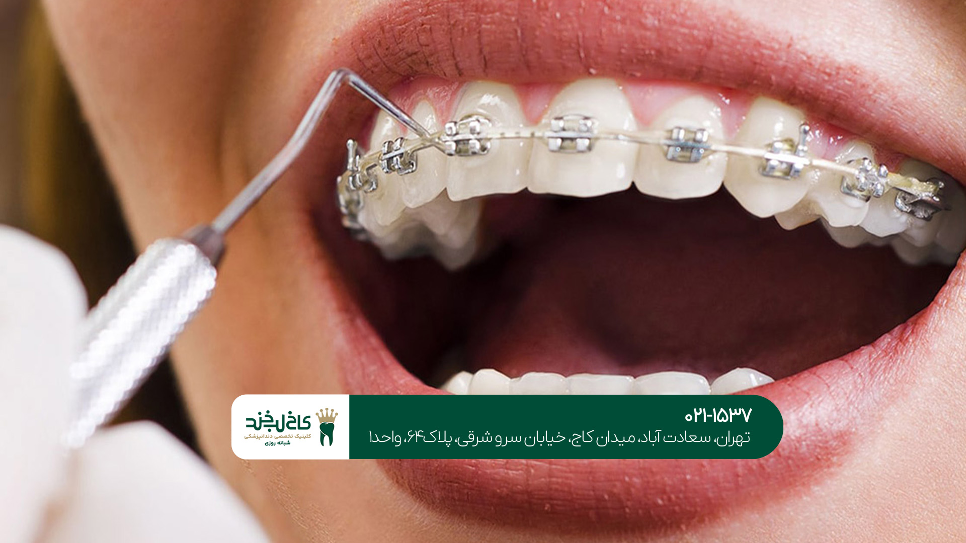 بهترین دندانپزشک در شمال تهران بهترین دندانپزشک در شمال تهران