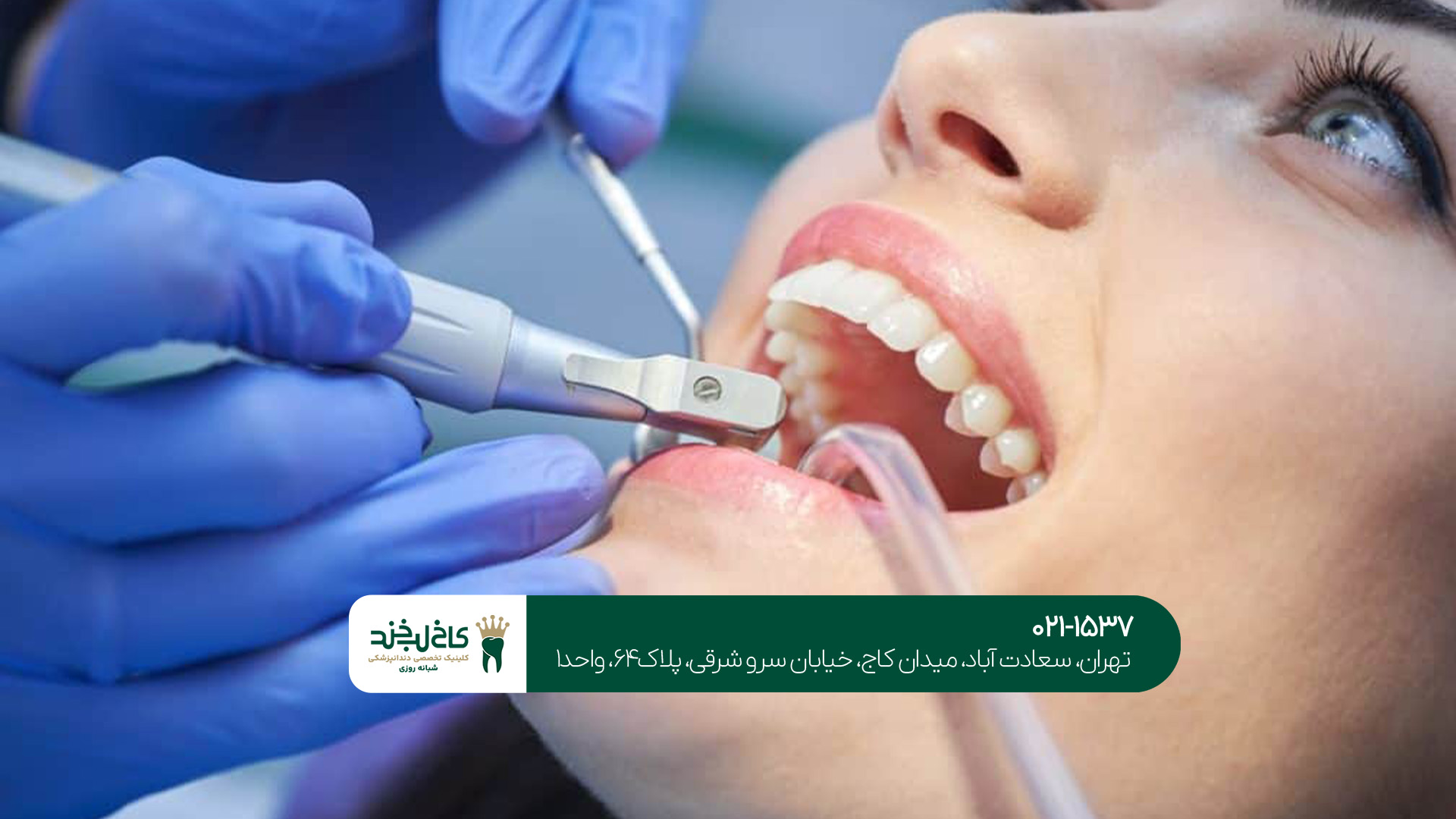 بهترین مرکز دندانپزشکی شمال تهران بهترین مرکز دندانپزشکی شمال تهران