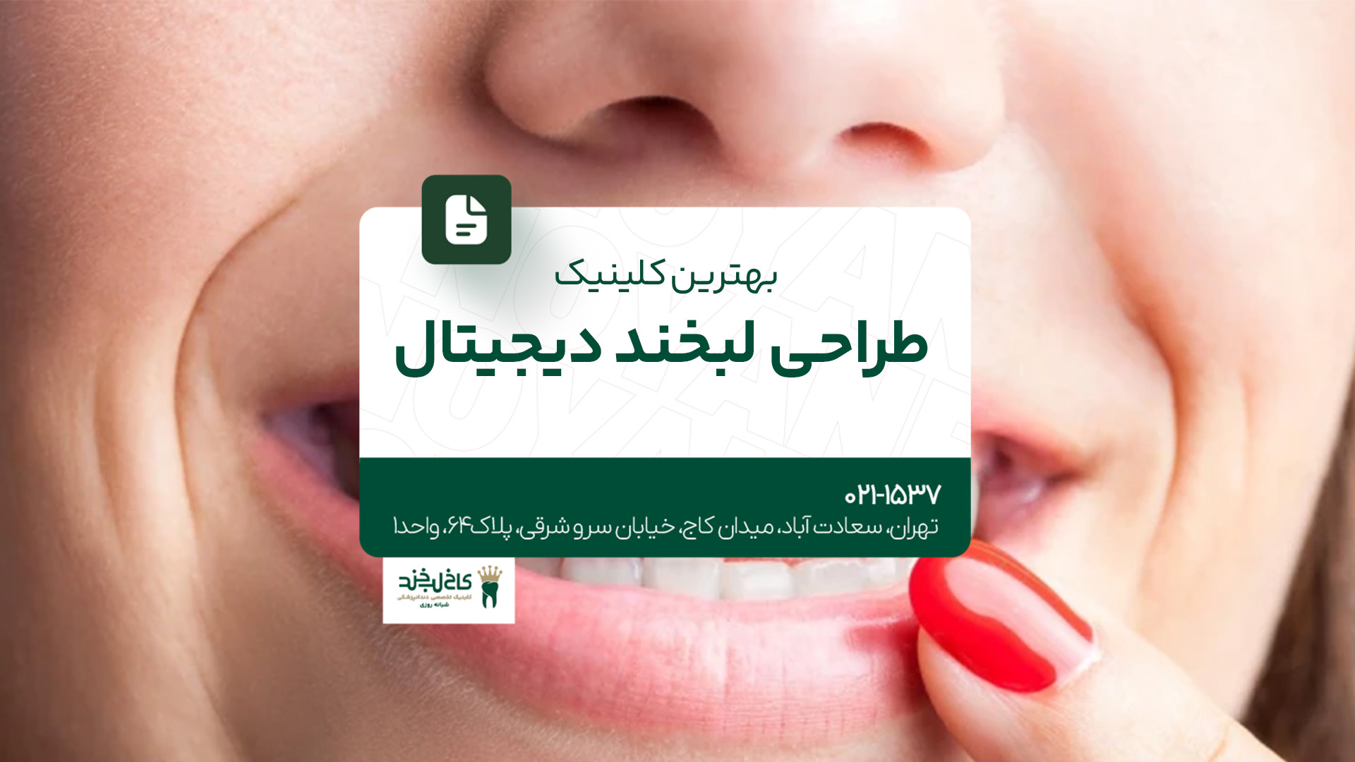 بهترین کلینیک طراحی لبخند دیجیتال بهترین کلینیک طراحی لبخند دیجیتال