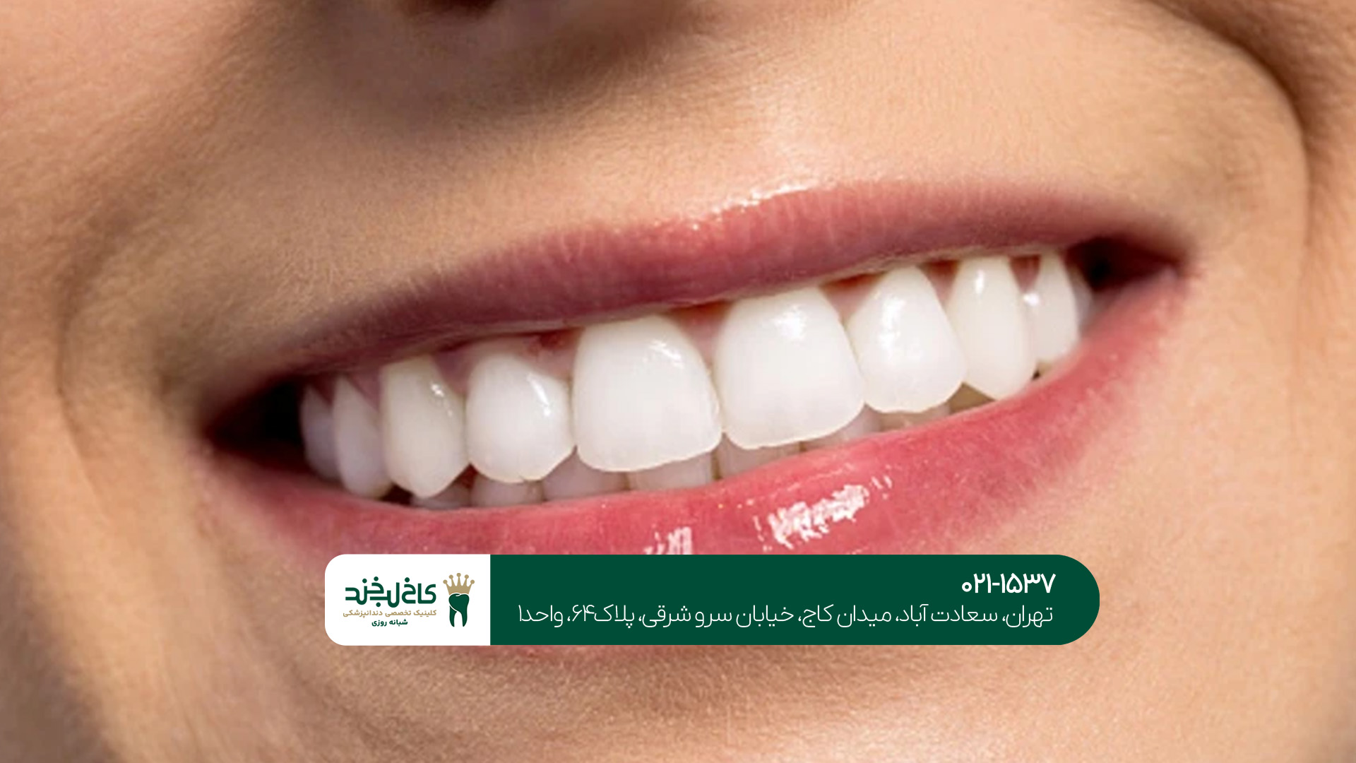 بهترین کلینیک طراحی لبخند دیجیتال بهترین کلینیک طراحی لبخند دیجیتال