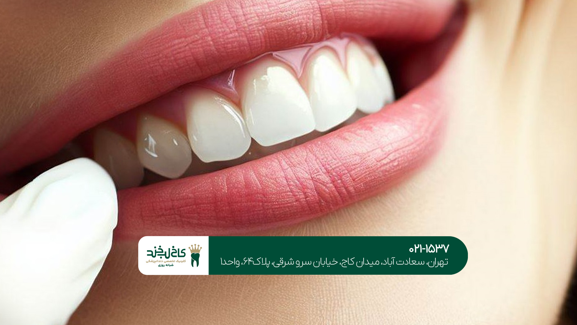 ترمیم دندان حرفهای ترمیم دندان حرفهای