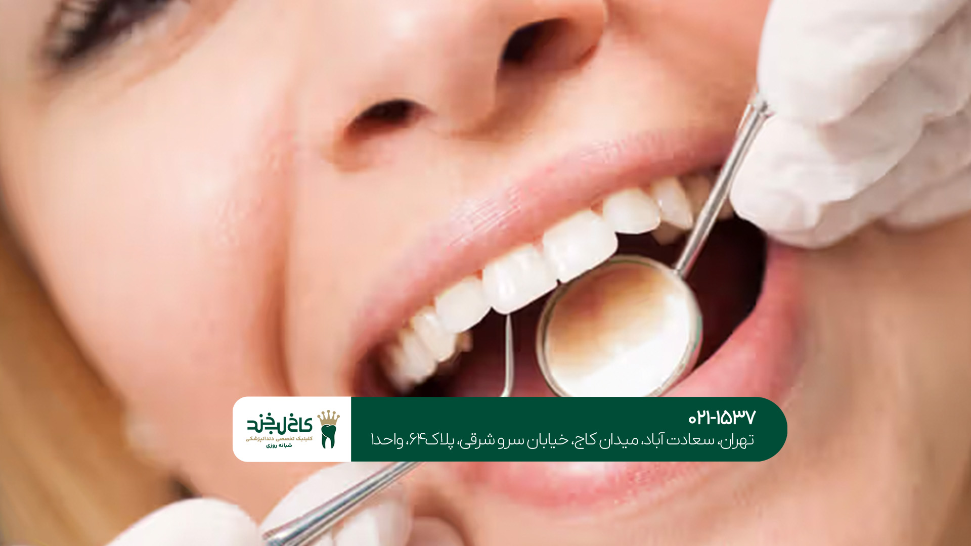 ترمیم دندان حرفهای ترمیم دندان حرفهای