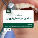 جرمگیری دندان در شمال تهران
