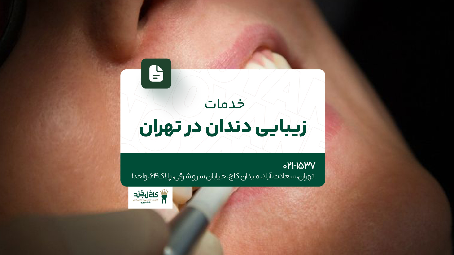 خدمات زیبایی دندان در تهران