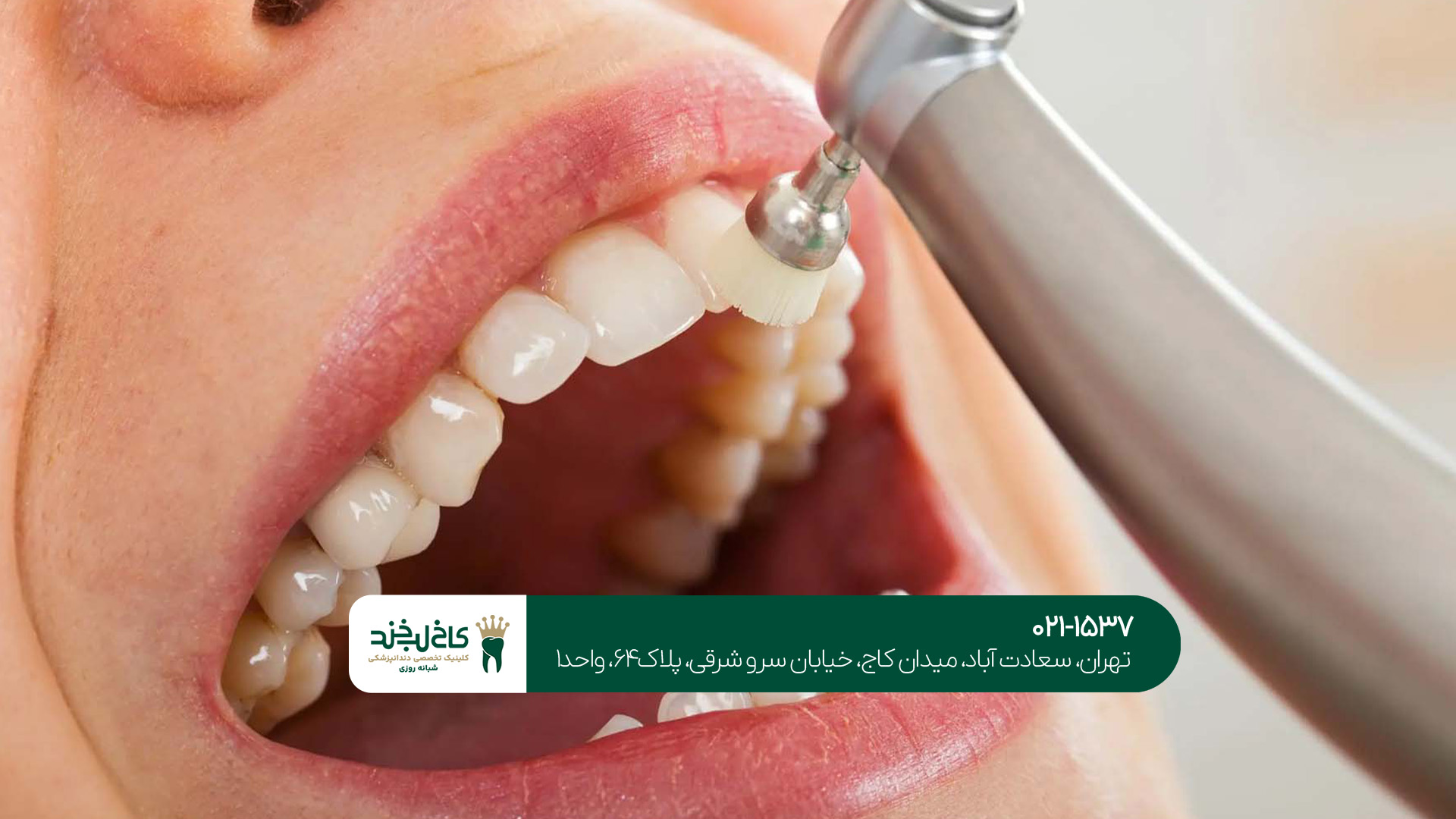 خدمات درمانی و زیبایی دندان قسطی خدمات درمانی و زیبایی دندان قسطی