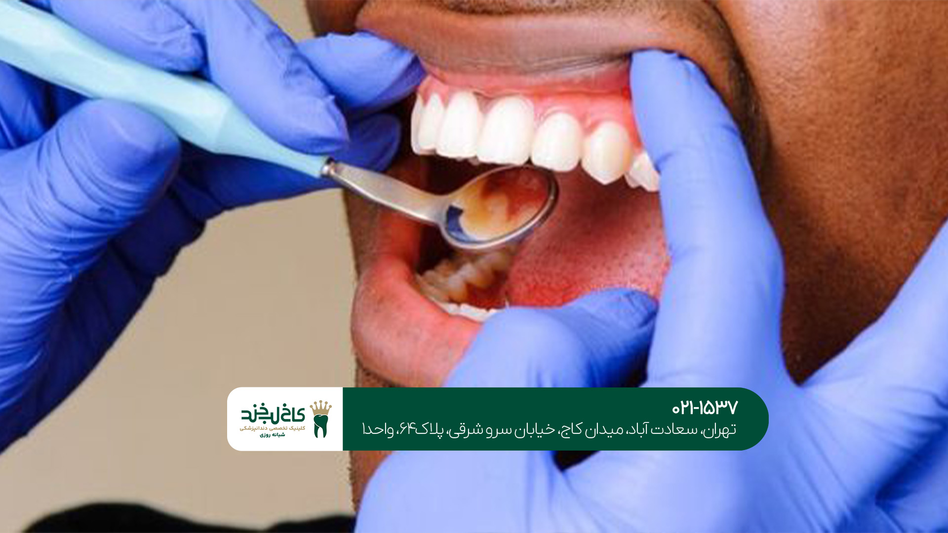 دندانپزشکی تخصصی زیبایی دندانپزشکی تخصصی زیبایی