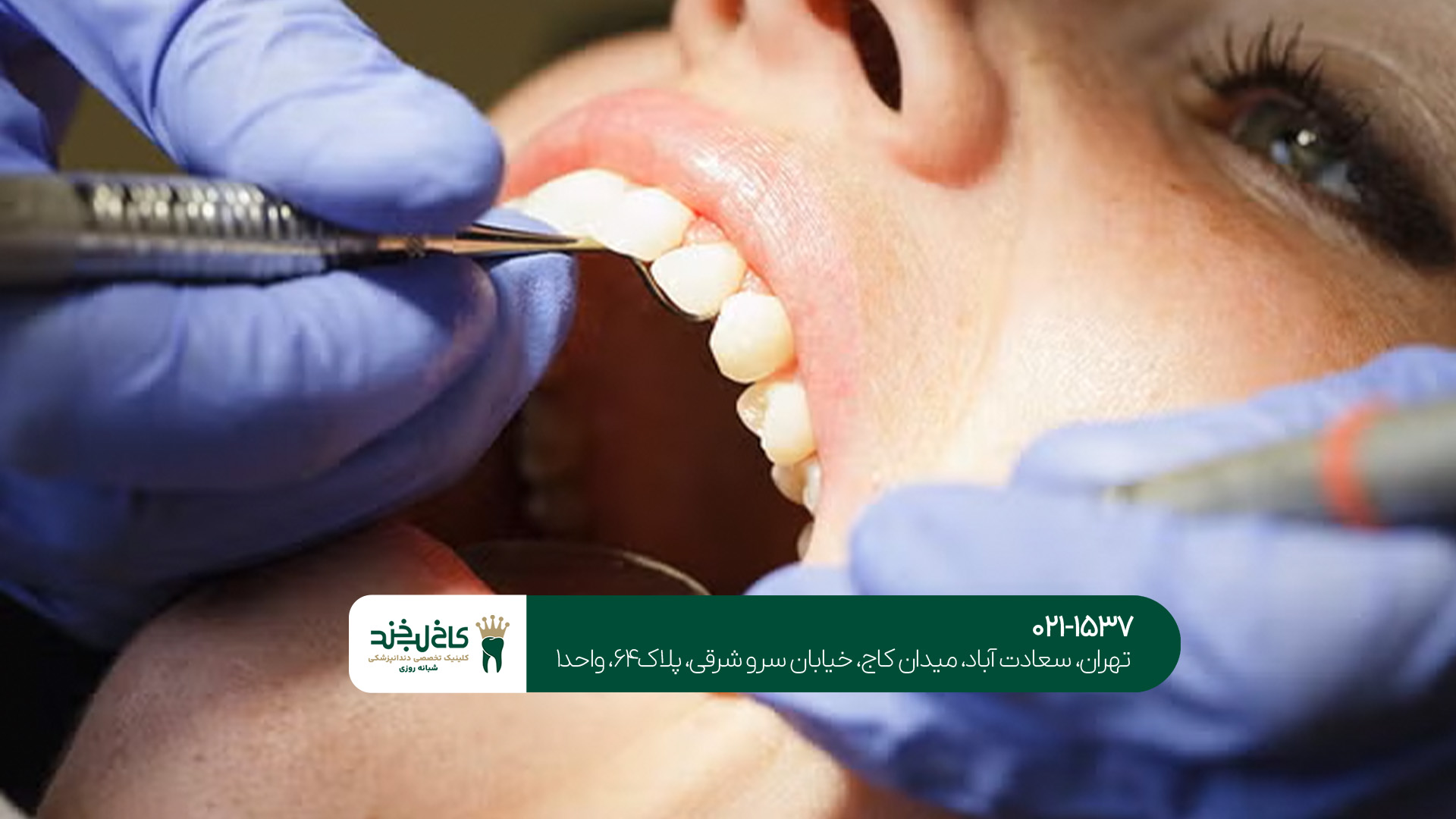 دندانپزشکی زیبایی در الهیه دندانپزشکی زیبایی در الهیه