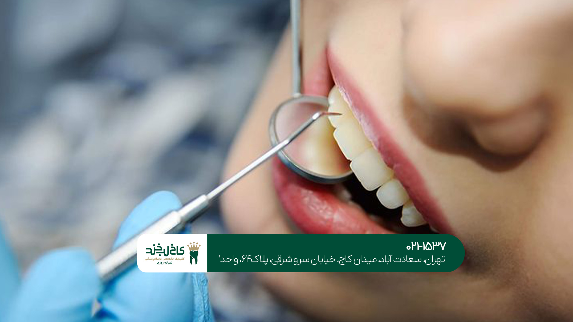 دندانپزشکی زیبایی در الهیه دندانپزشکی زیبایی در الهیه