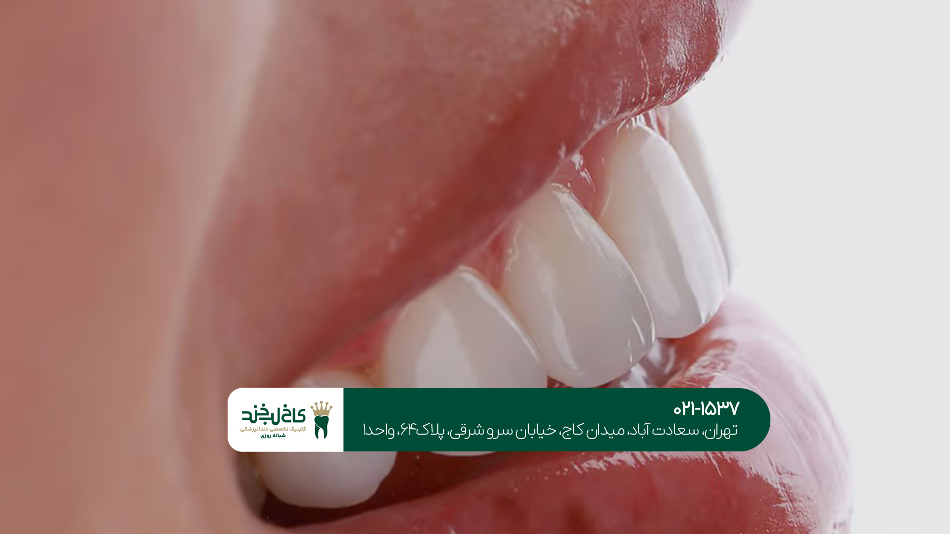 دندانپزشکی زیبایی تهران دندانپزشکی زیبایی تهران