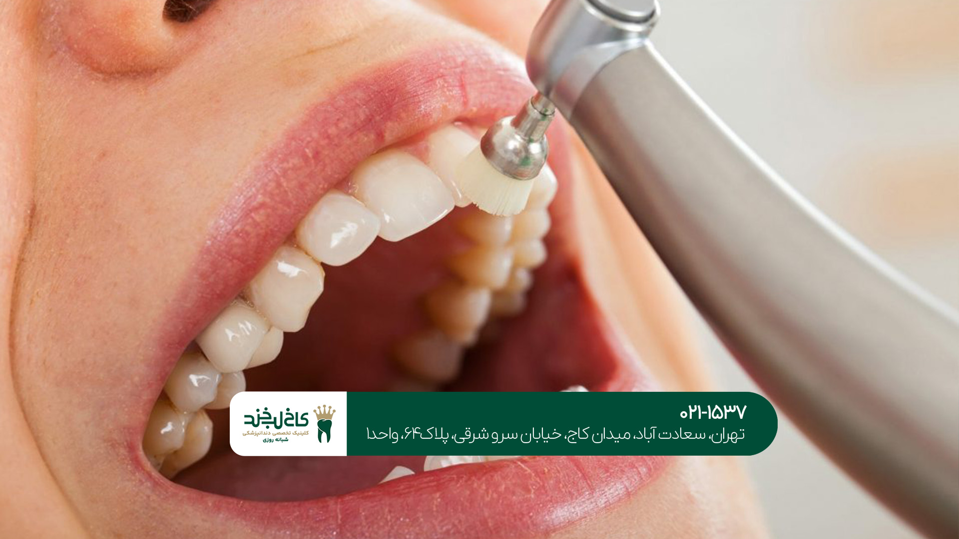 دندانپزشکی زیبایی تهران دندانپزشکی زیبایی تهران