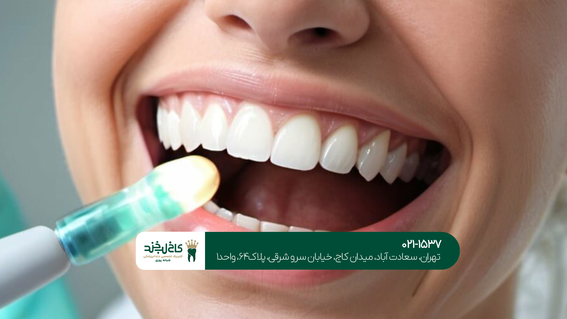 دندانپزشکی زیبایی تهران دندانپزشکی زیبایی تهران