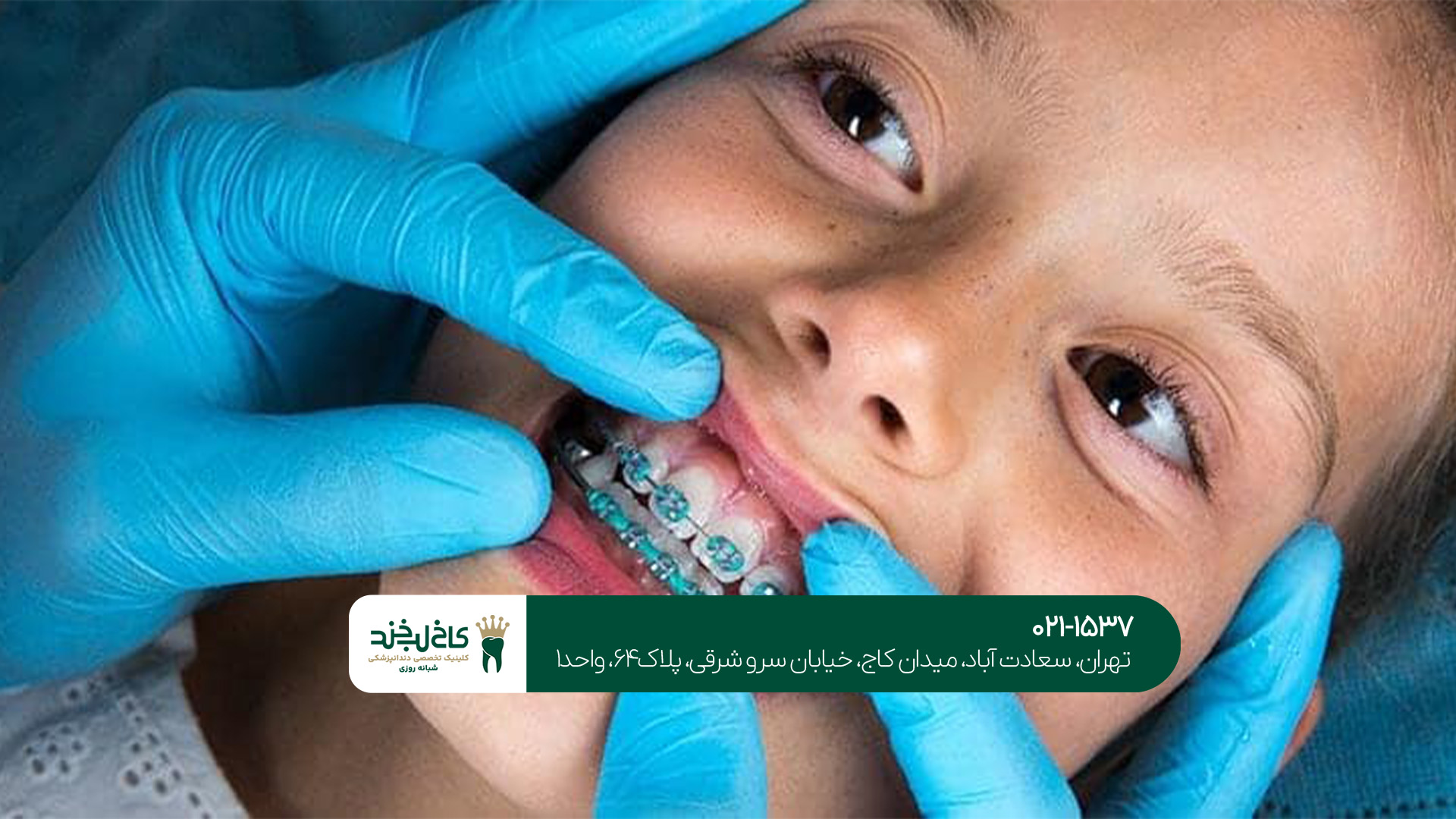 دندانپزشکی اطفال حرفه ای تهران دندانپزشکی اطفال حرفه ای تهران