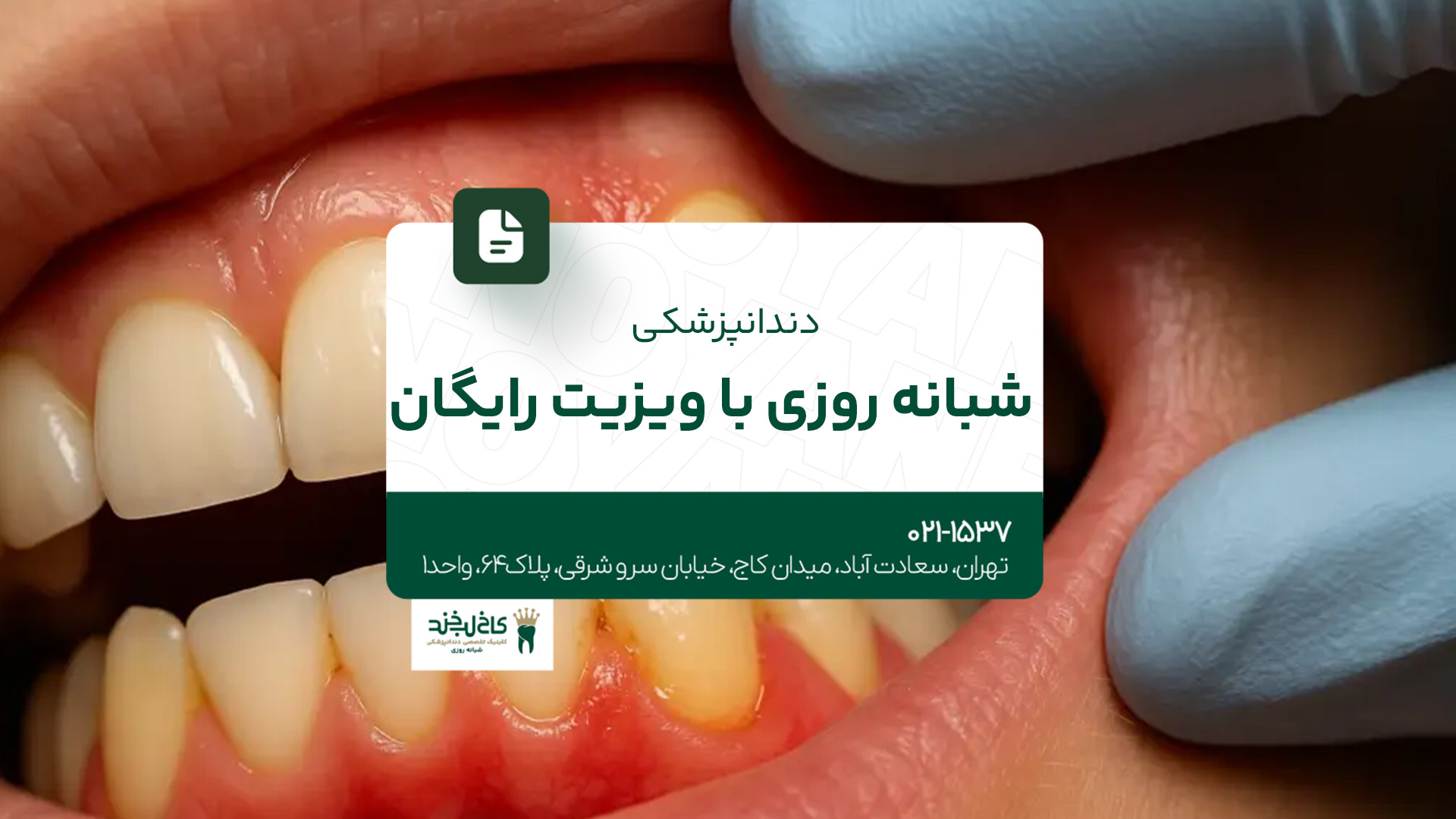 دندانپزشکی شبانه‌روزی با ویزیت رایگان