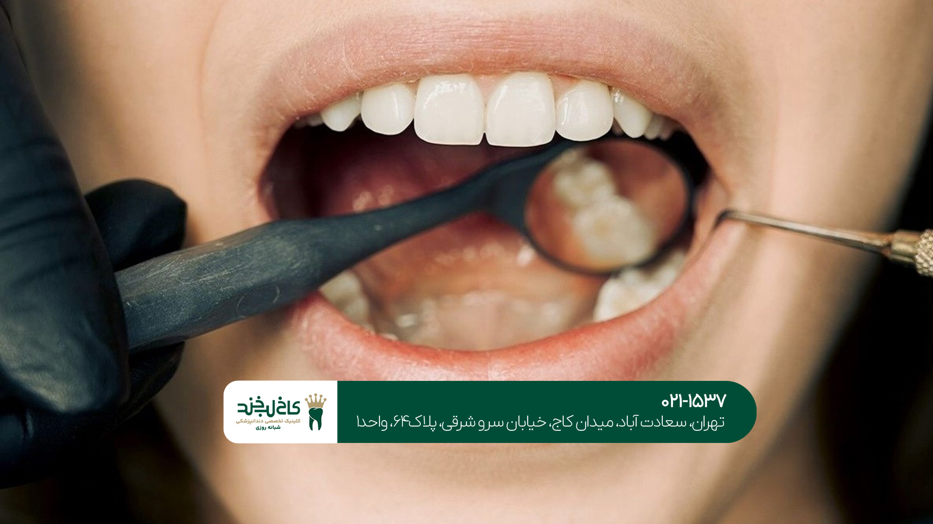 دندانپزشکی شبانه‌روزی با ویزیت رایگان