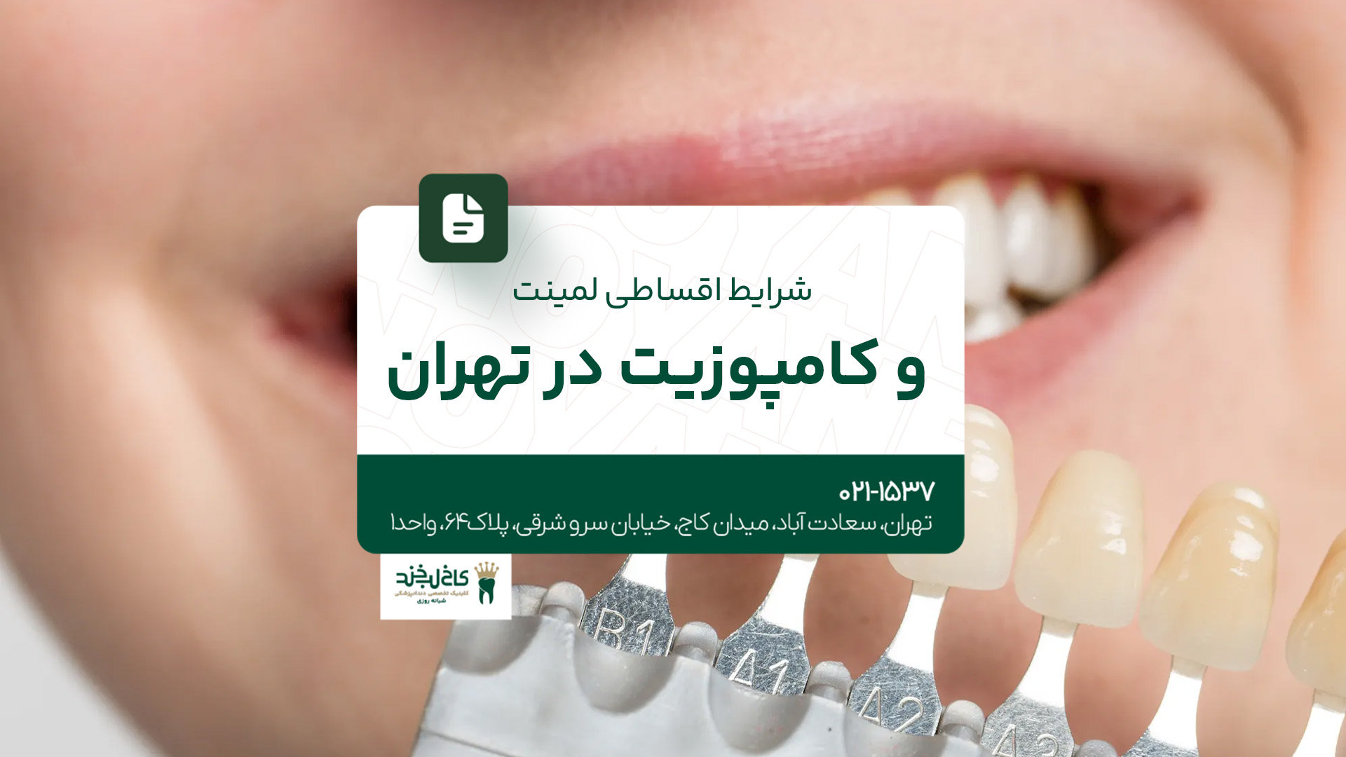 شرایط اقساطی لمینت و کامپوزیت در تهران