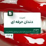 لمینت دندان حرفه ای