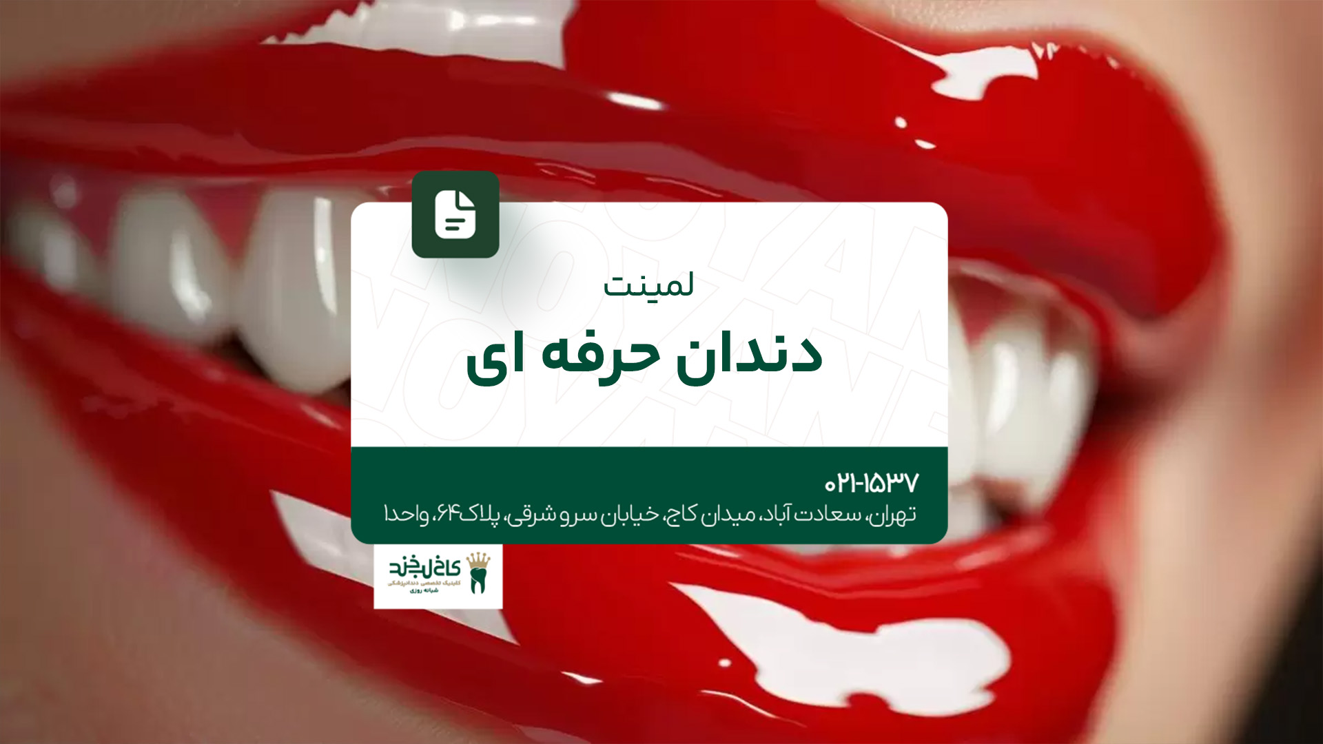 لمینت دندان حرفه ای لمینت دندان حرفه ای