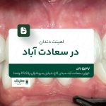 لمینت دندان در سعادتآباد