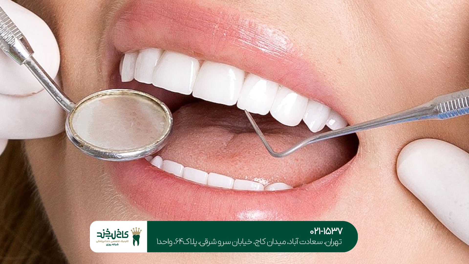 خدمات زیبایی دندان