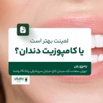 لمینت بهتر است یا کامپوزیت دندان؟