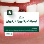 مرکز ایمپلنت یک روزه در تهران